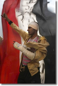 Egyptian protestor with broken arm & head
